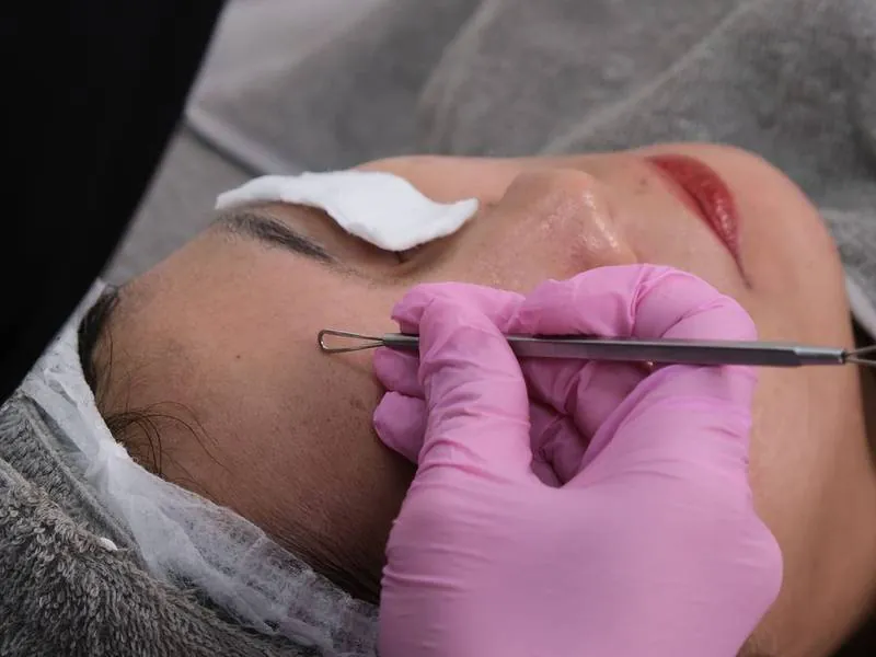 Limpieza facial profunda